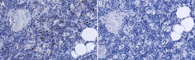 Anti-TdT/DNTT Antibody, clone 41A