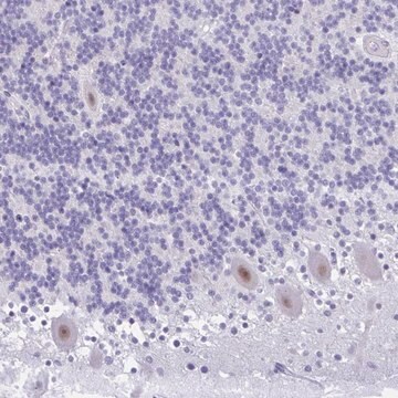 Anti-GLB1L2 antibody produced in rabbit Prestige Antibodies&#174; Powered by Atlas Antibodies, affinity isolated antibody, buffered aqueous glycerol solution