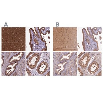 Anti-KLC2 antibody produced in rabbit Prestige Antibodies&#174; Powered by Atlas Antibodies, affinity isolated antibody, buffered aqueous glycerol solution