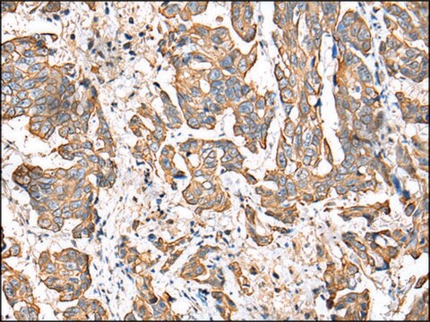 Anti-RABL2B affinity isolated antibody