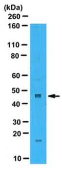 Anti-Zinc Finger Protein 260 Antibody serum, from rabbit