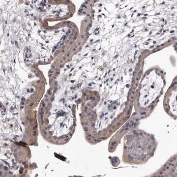 Anti-GAPVD1 antibody produced in rabbit Prestige Antibodies&#174; Powered by Atlas Antibodies, affinity isolated antibody, buffered aqueous glycerol solution, ab2