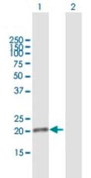 Anti-DDIT4L antibody produced in mouse purified immunoglobulin, buffered aqueous solution