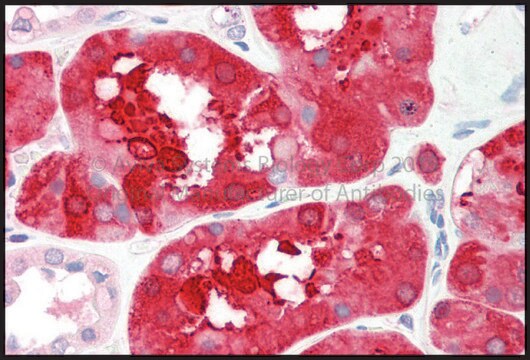 Anti-ALDOB antibody produced in rabbit affinity isolated antibody