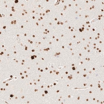 Anti-ZSCAN18 antibody produced in rabbit Prestige Antibodies&#174; Powered by Atlas Antibodies, affinity isolated antibody, buffered aqueous glycerol solution