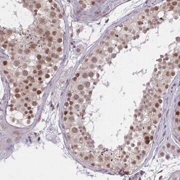 Anti-ZNF414 antibody produced in rabbit Prestige Antibodies&#174; Powered by Atlas Antibodies, affinity isolated antibody, buffered aqueous glycerol solution