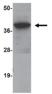 Anti-SIRT4 Antibody from rabbit, purified by affinity chromatography