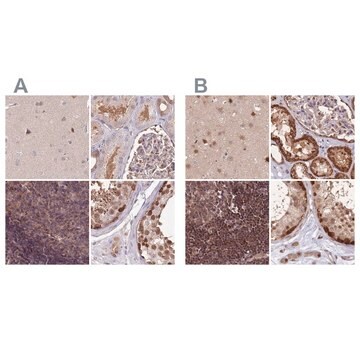 Anti-NSFL1C antibody produced in rabbit Prestige Antibodies&#174; Powered by Atlas Antibodies, affinity isolated antibody, buffered aqueous glycerol solution