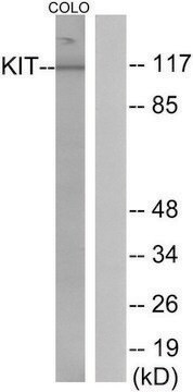 Anti-KIT antibody produced in rabbit affinity isolated antibody