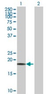 Anti-CAPS antibody produced in rabbit purified immunoglobulin, buffered aqueous solution