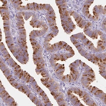 Anti-DYNC2LI1 antibody produced in rabbit Prestige Antibodies&#174; Powered by Atlas Antibodies, affinity isolated antibody, buffered aqueous glycerol solution