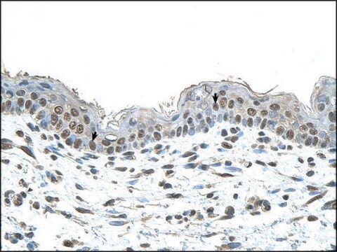 Anti-SMAD1 (AB2) antibody produced in rabbit IgG fraction of antiserum