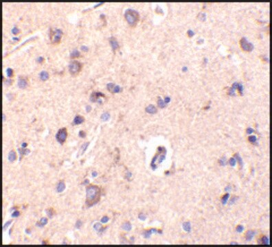 Anti-CTRP2 (ab1) antibody produced in rabbit affinity isolated antibody, buffered aqueous solution