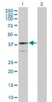 Anti-BDH1 antibody produced in rabbit purified immunoglobulin, buffered aqueous solution