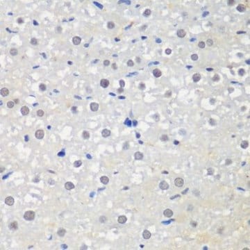 Anti-CTCF antibody produced in rabbit