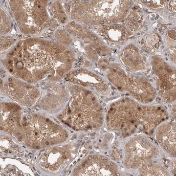 Anti-CCDC190 antibody produced in rabbit Prestige Antibodies&#174; Powered by Atlas Antibodies, affinity isolated antibody, buffered aqueous glycerol solution, ab1