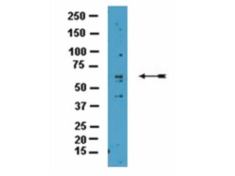 Anti-CARM1 Antibody from rabbit