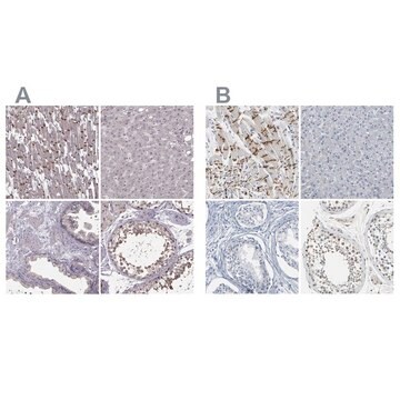 Anti-PKP2 antibody produced in rabbit Prestige Antibodies&#174; Powered by Atlas Antibodies, affinity isolated antibody