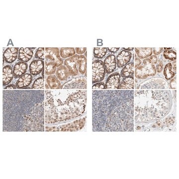 Anti-MRM3 antibody produced in rabbit Prestige Antibodies&#174; Powered by Atlas Antibodies, affinity isolated antibody, buffered aqueous glycerol solution, Ab2