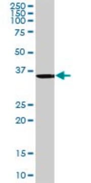 Anti-ANKRA2 antibody produced in rabbit purified immunoglobulin, buffered aqueous solution