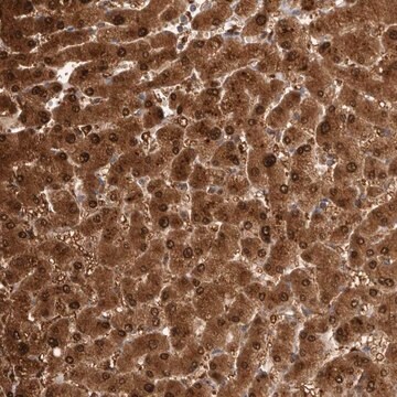 Anti-PGM1 antibody produced in rabbit Prestige Antibodies&#174; Powered by Atlas Antibodies, affinity isolated antibody, buffered aqueous glycerol solution, Ab2