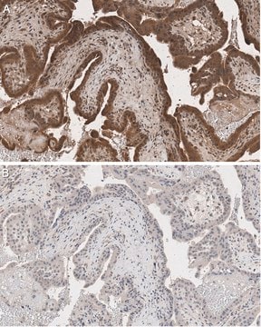 Anti-Legumain/Asparaginyl endopeptidase antibody Clone 6E3