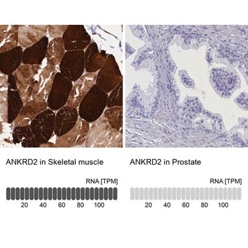 Anti-ANKRD2 antibody produced in rabbit Prestige Antibodies&#174; Powered by Atlas Antibodies, affinity isolated antibody, buffered aqueous glycerol solution