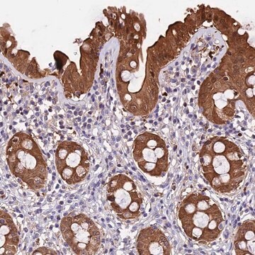 Anti-MAP3K7CL antibody produced in rabbit Prestige Antibodies&#174; Powered by Atlas Antibodies, affinity isolated antibody, buffered aqueous glycerol solution