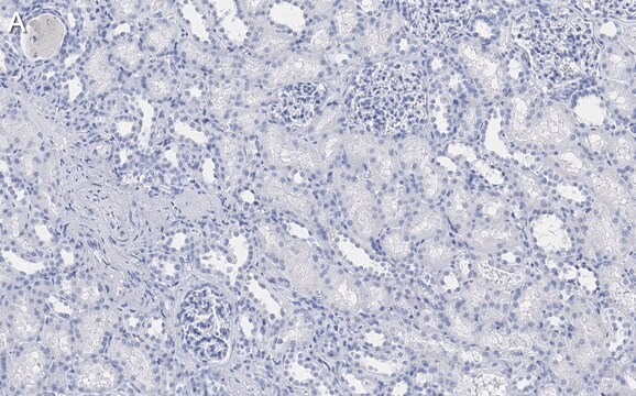 Anti-DIP2B Antibody, clone 2C8, ZooMAb&#174; Rabbit Monoclonal recombinant, expressed in HEK 293 cells