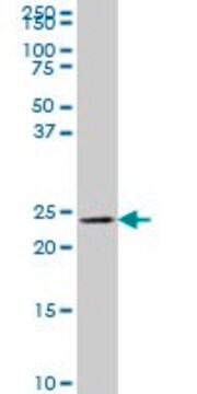 Monoclonal Anti-MLC1SA antibody produced in mouse clone 4G11, purified immunoglobulin, buffered aqueous solution