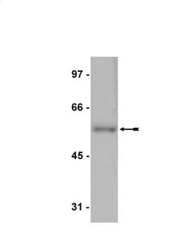 Anti-E2F-4 Antibody, clone GG22-2A6 clone GG22-2A6, Upstate&#174;, from mouse