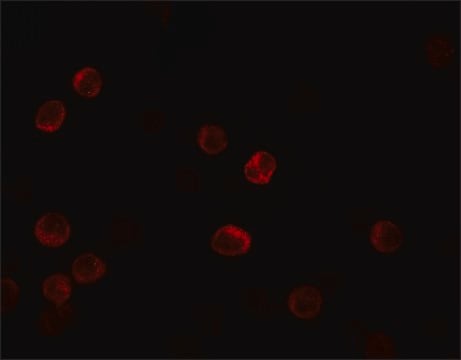 Anti-IL-28B antibody produced in rabbit affinity isolated antibody