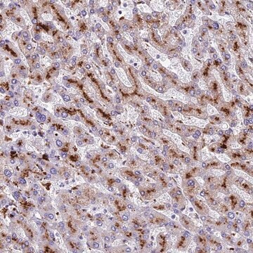 Anti-THRSP antibody produced in rabbit Prestige Antibodies&#174; Powered by Atlas Antibodies, affinity isolated antibody, buffered aqueous glycerol solution