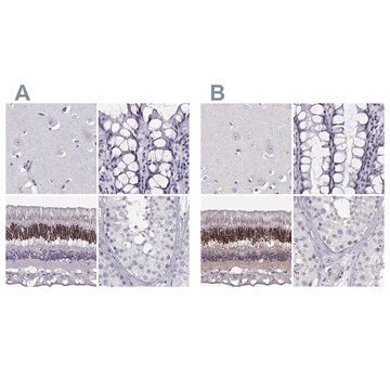 Anti-CRX antibody produced in rabbit Prestige Antibodies&#174; Powered by Atlas Antibodies, affinity isolated antibody, buffered aqueous glycerol solution