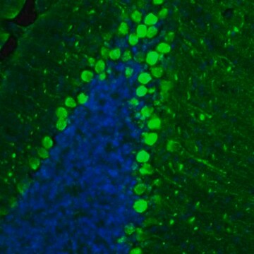 Anti-BCAR1 antibody produced in rabbit Prestige Antibodies&#174; Powered by Atlas Antibodies, affinity isolated antibody, buffered aqueous glycerol solution