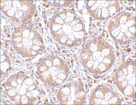 Anti-TEM2 antibody produced in rabbit affinity isolated antibody, buffered aqueous solution