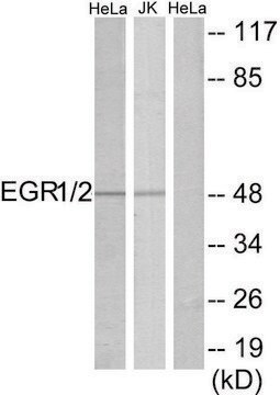 Anti-EGR1 antibody produced in rabbit affinity isolated antibody