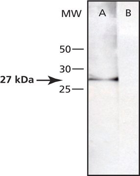 Anti-Ubiquitin C-terminal Hydrolase L1 (MA-18) antibody produced in rabbit IgG fraction of antiserum, buffered aqueous solution