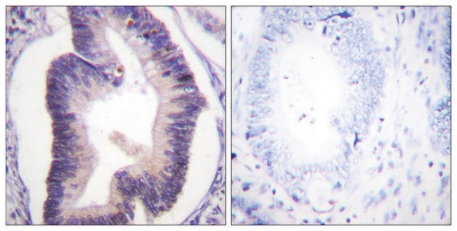 Anti-Fructose 6 Phosphate Kinase antibody produced in rabbit affinity isolated antibody