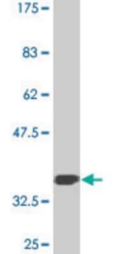 Monoclonal Anti-GLS, (C-terminal) antibody produced in mouse clone 6H1, purified immunoglobulin, buffered aqueous solution