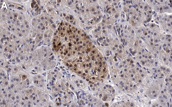 Anti-ACLY Antibody, clone 1B16 ZooMAb&#174; Rabbit Monoclonal recombinant, expressed in HEK 293 cells