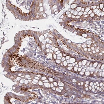 Anti-C3ORF36 antibody produced in rabbit Prestige Antibodies&#174; Powered by Atlas Antibodies, affinity isolated antibody, buffered aqueous glycerol solution