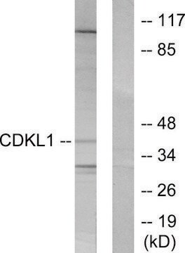 Anti-CDKL1 antibody produced in rabbit affinity isolated antibody