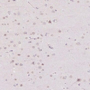 Anti-TBX15 antibody produced in rabbit Prestige Antibodies&#174; Powered by Atlas Antibodies, affinity isolated antibody, buffered aqueous glycerol solution