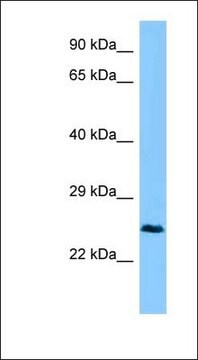 Anti-CTHRC1 antibody produced in rabbit affinity isolated antibody