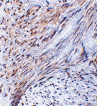 Anti-TRIM5 alpha antibody produced in rabbit affinity isolated antibody