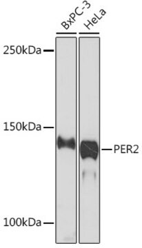 Anti-PER2 Antibody, clone 2K9Y0, Rabbit Monoclonal