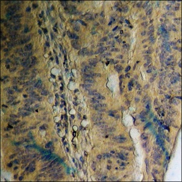 Anti-phospho-EGFR (pThr693) antibody produced in rabbit affinity isolated antibody