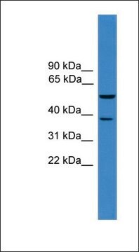 Anti-BACE1 antibody produced in rabbit affinity isolated antibody