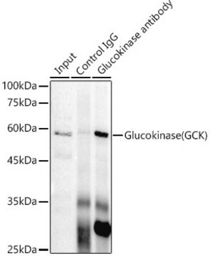 Anti-Glucokinase (GCK) Antibody, clone 4K9D5, Rabbit Monoclonal